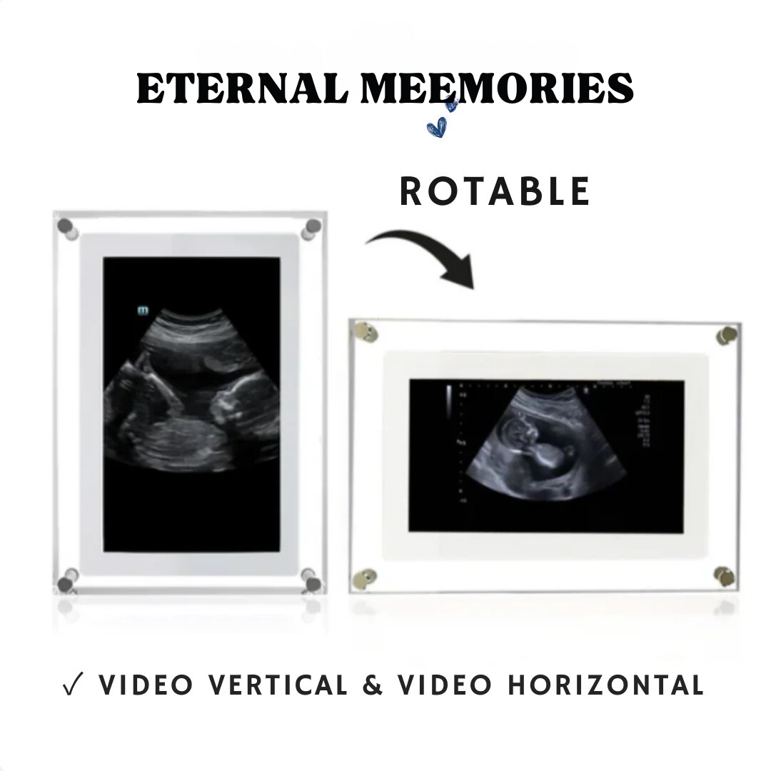 Eternal Meemories™ Marco Digital