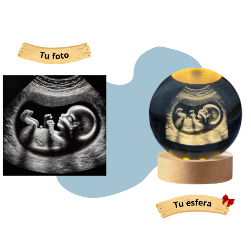 Esfera Personalizada